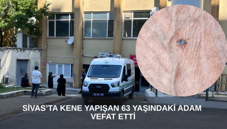 Sivas’ta Kene Can Aldı: 63 Yaşındaki Adam Hayatını Kaybetti